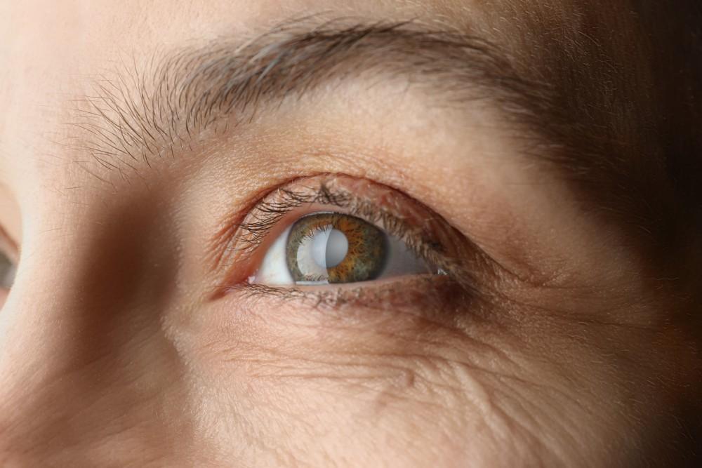 Detailed view of eye and brow