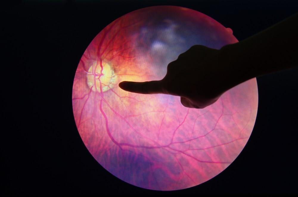 Finger pointing at a retinal image.