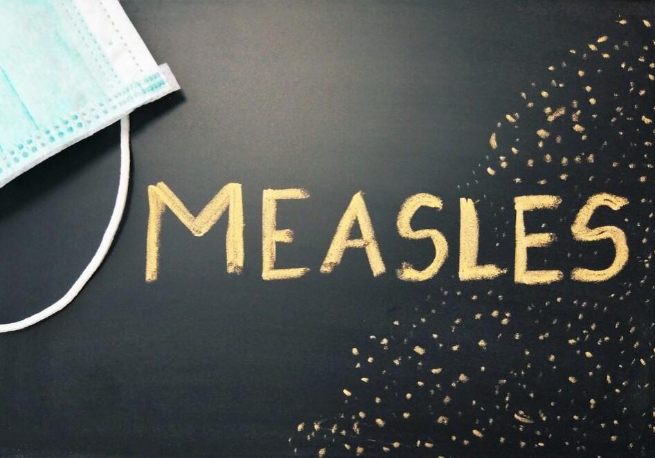 Measles written on chalkboard with mask